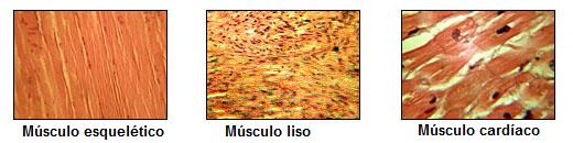 tipos musculo.jpg